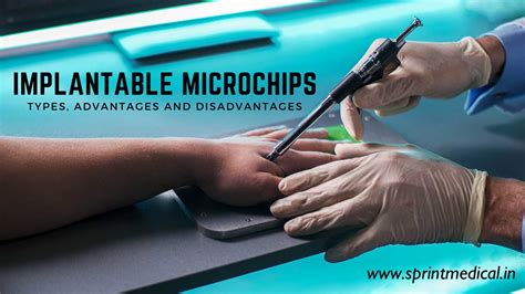 implantable rfid chips|chip implantation in humans.